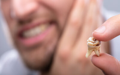 拔牙後醫師補充說明 Tooth extraction