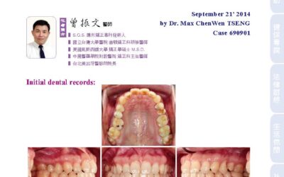 An orthodontic-prosthetic case report using S.O.S. invisible braces｜曾醫師學術專欄｜天母美加牙醫診所