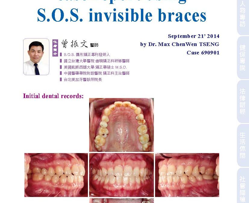 An orthodontic-prosthetic case report using S.O.S. invisible braces｜曾醫師學術專欄｜天母美加牙醫診所